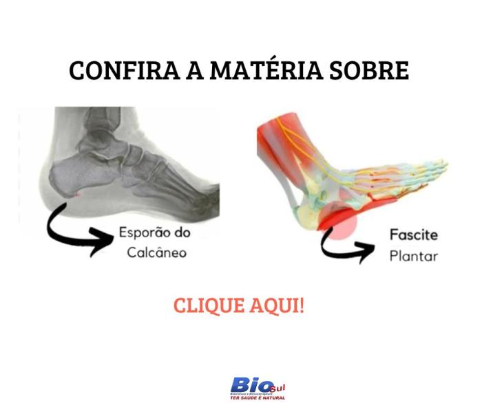Esporão calcâneo 